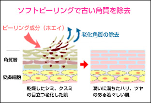 角質除去の図